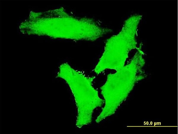 CHUK Antibody in Immunocytochemistry (ICC/IF)