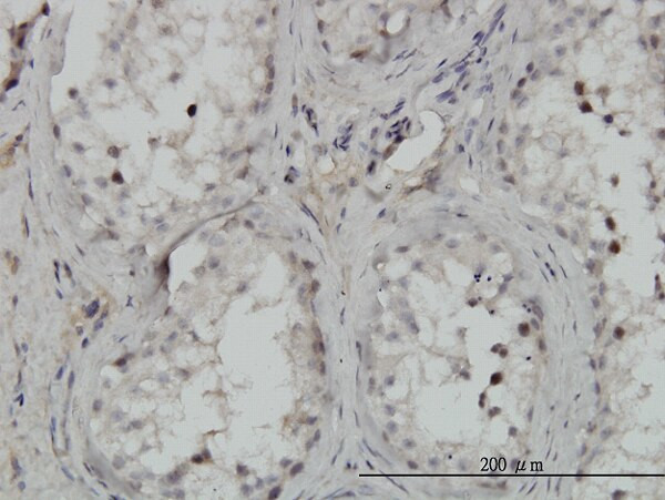 CHUK Antibody in Immunohistochemistry (Paraffin) (IHC (P))