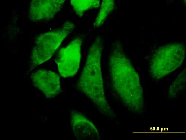 CHUK Antibody in Immunocytochemistry (ICC/IF)