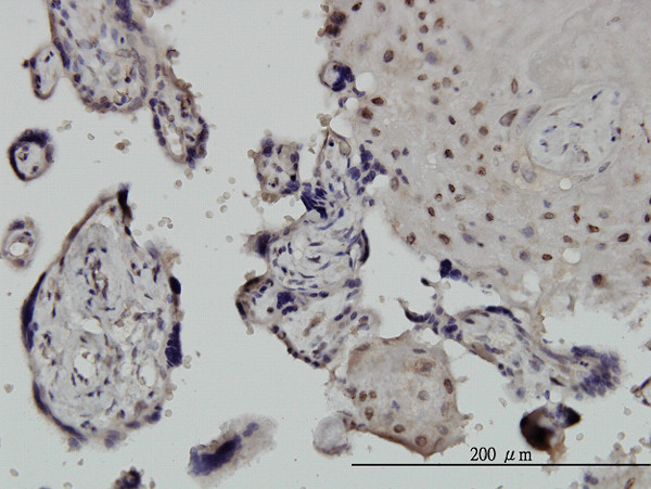 CHUK Antibody in Immunohistochemistry (Paraffin) (IHC (P))