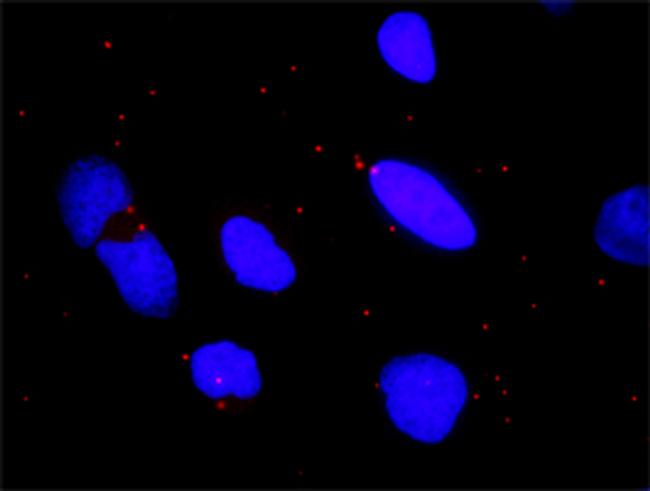 CHUK Antibody in Proximity Ligation Assay (PLA) (PLA)