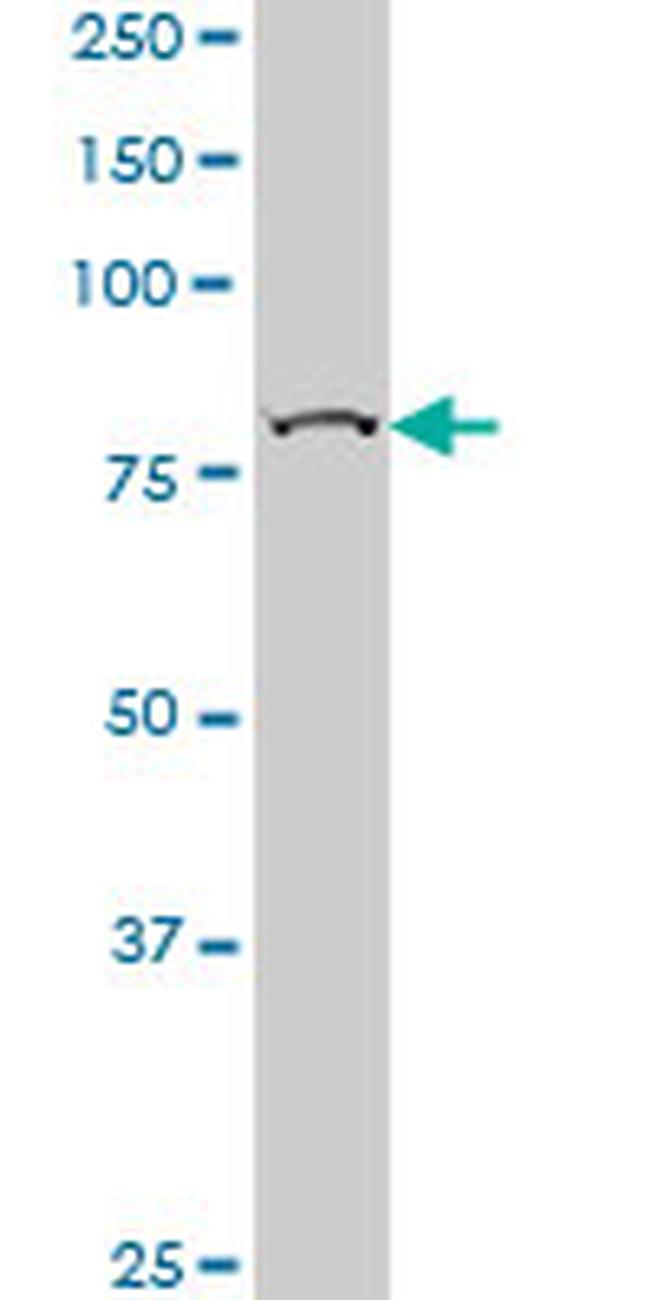 CHUK Antibody in Western Blot (WB)