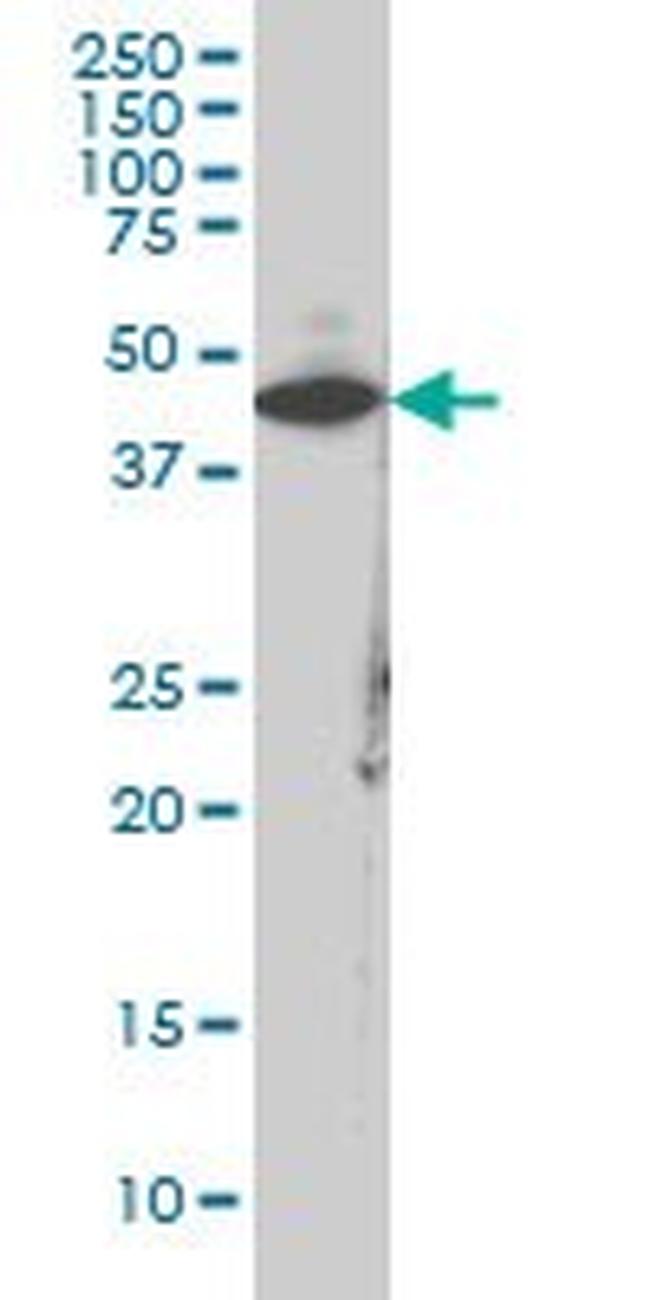 CKM Antibody in Western Blot (WB)