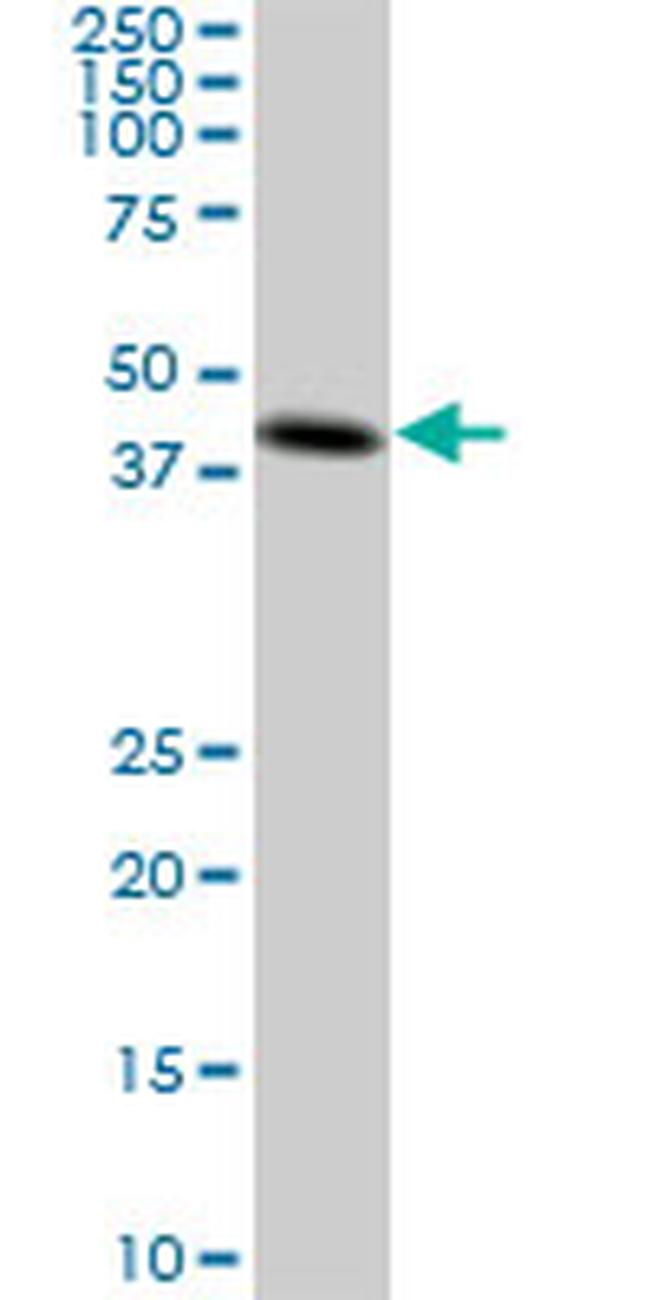 CKMT1B Antibody in Western Blot (WB)