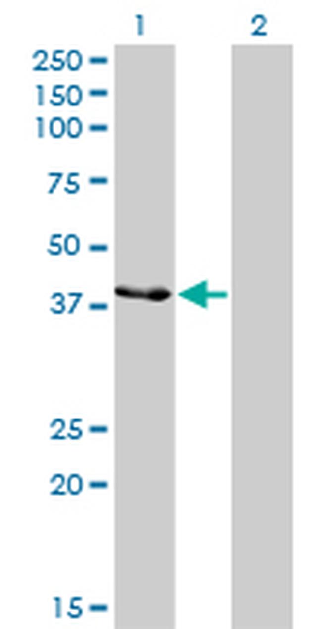 CKMT1B Antibody in Western Blot (WB)