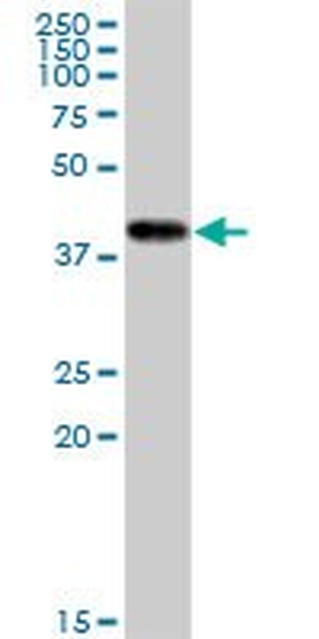 CKMT1B Antibody in Western Blot (WB)