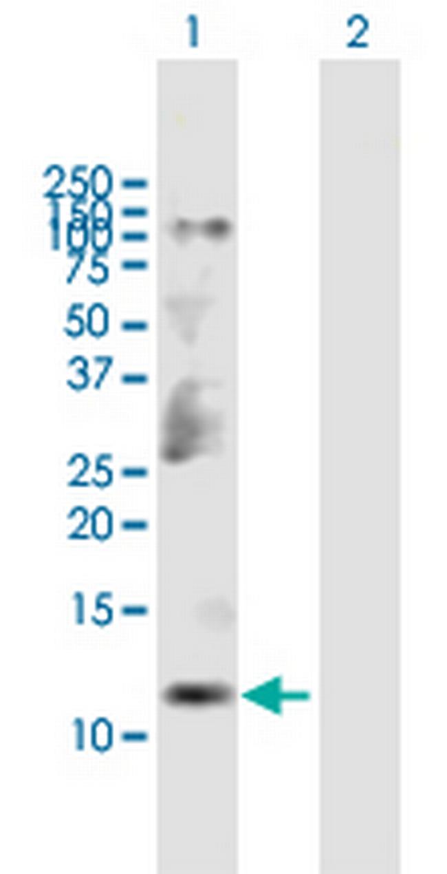 CKS2 Antibody in Western Blot (WB)