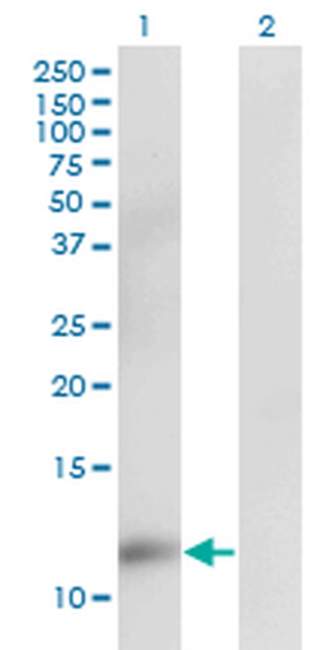 CKS2 Antibody in Western Blot (WB)