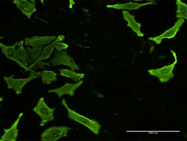 CKS2 Antibody in Immunocytochemistry (ICC/IF)