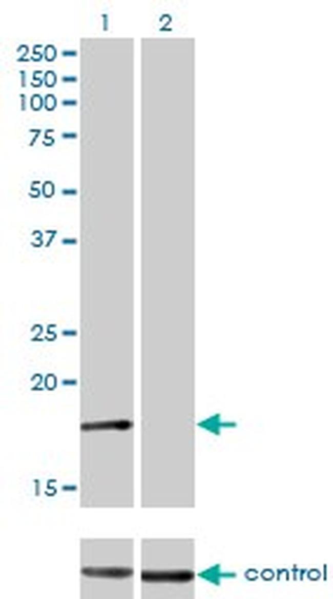 AP2S1 Antibody in Western Blot (WB)