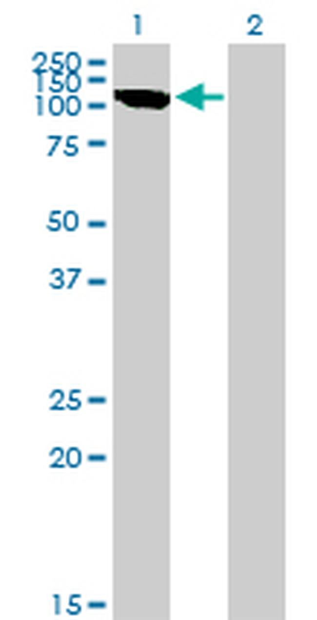 CLCN2 Antibody in Western Blot (WB)