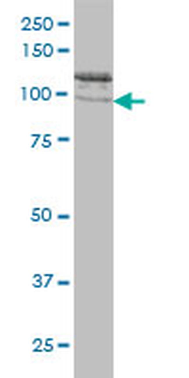 CLCN2 Antibody in Western Blot (WB)