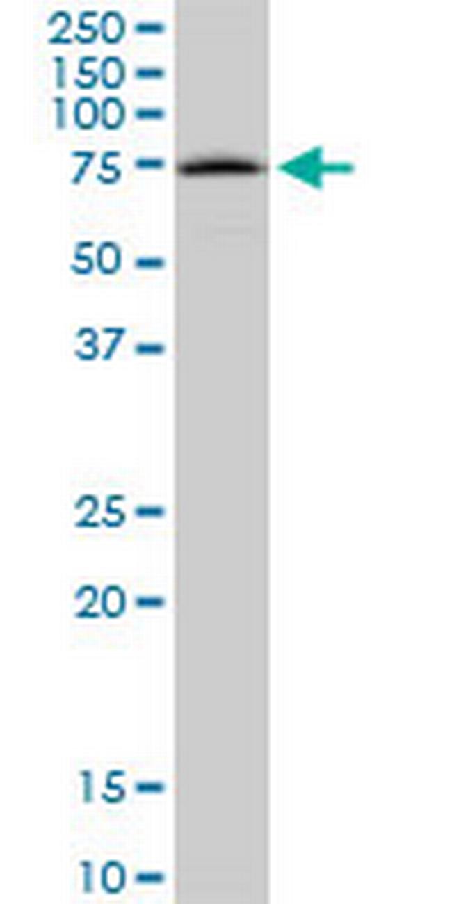 TPP1 Antibody in Western Blot (WB)