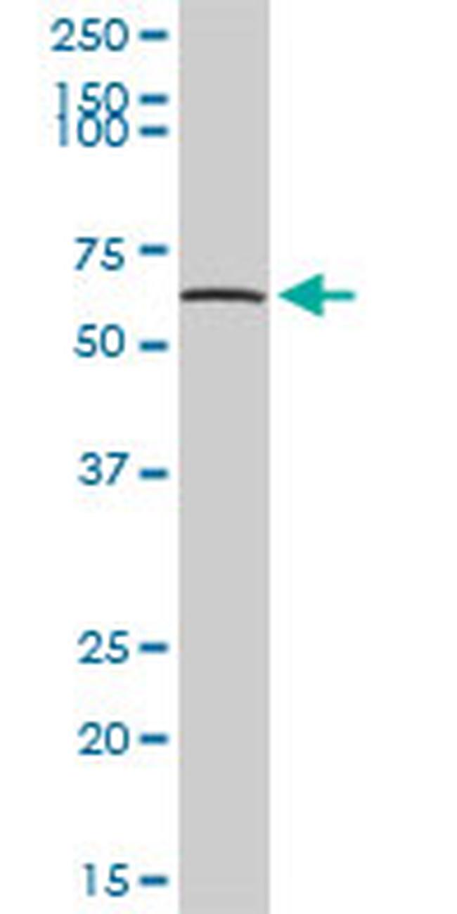 TPP1 Antibody in Western Blot (WB)