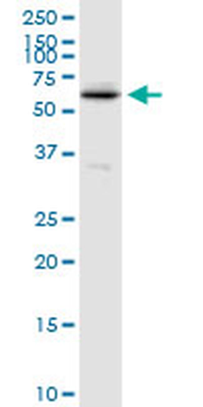 TPP1 Antibody in Western Blot (WB)