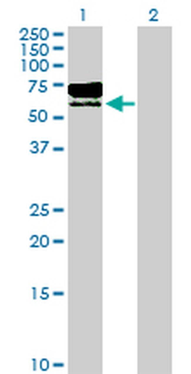 TPP1 Antibody in Western Blot (WB)