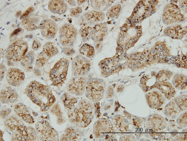 TPP1 Antibody in Immunohistochemistry (Paraffin) (IHC (P))