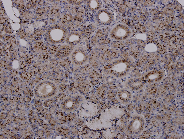 TPP1 Antibody in Immunohistochemistry (Paraffin) (IHC (P))