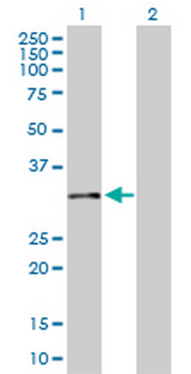 CNN2 Antibody in Western Blot (WB)