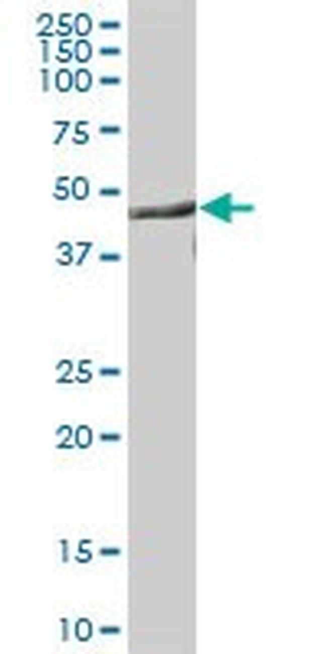 CNP Antibody in Western Blot (WB)