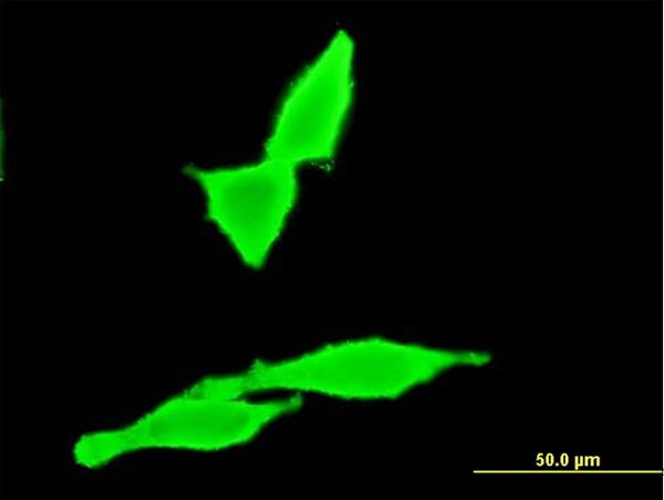 CNR2 Antibody in Immunocytochemistry (ICC/IF)