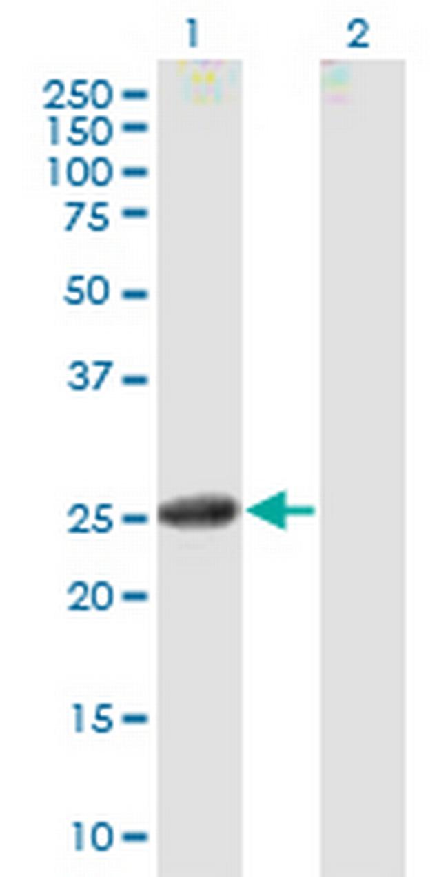 CNTF Antibody in Western Blot (WB)