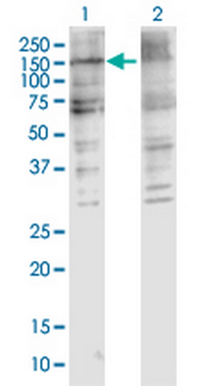 COL5A2 Antibody in Western Blot (WB)