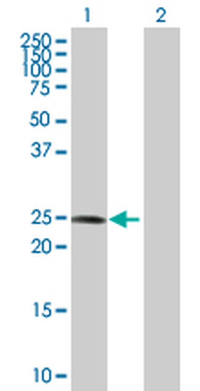 COMT Antibody in Western Blot (WB)