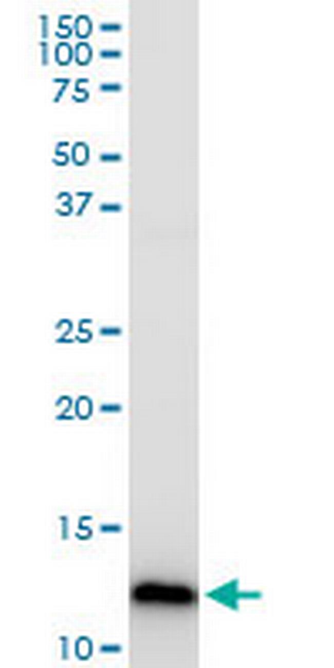 COX5B Antibody in Western Blot (WB)