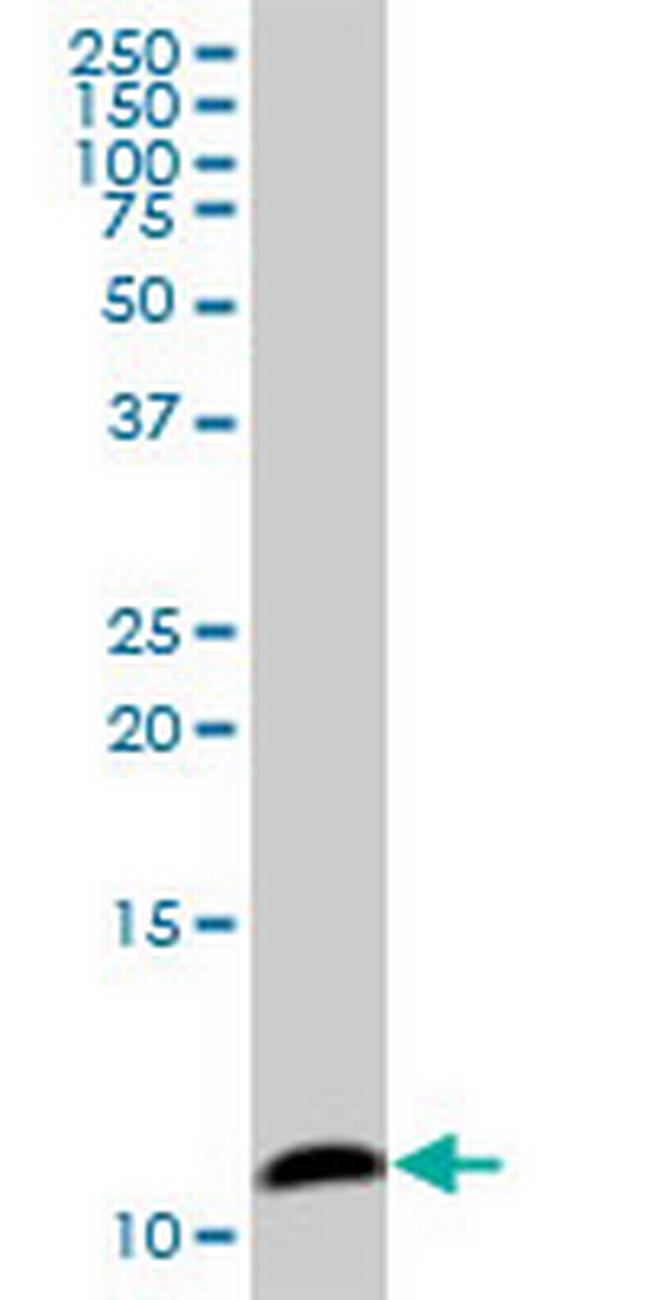 COX6B1 Antibody in Western Blot (WB)