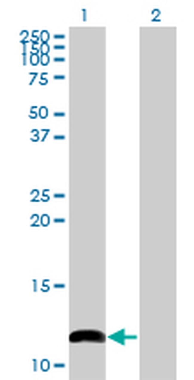 COX6B1 Antibody in Western Blot (WB)