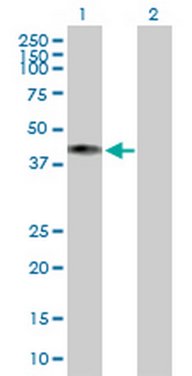 COX10 Antibody in Western Blot (WB)