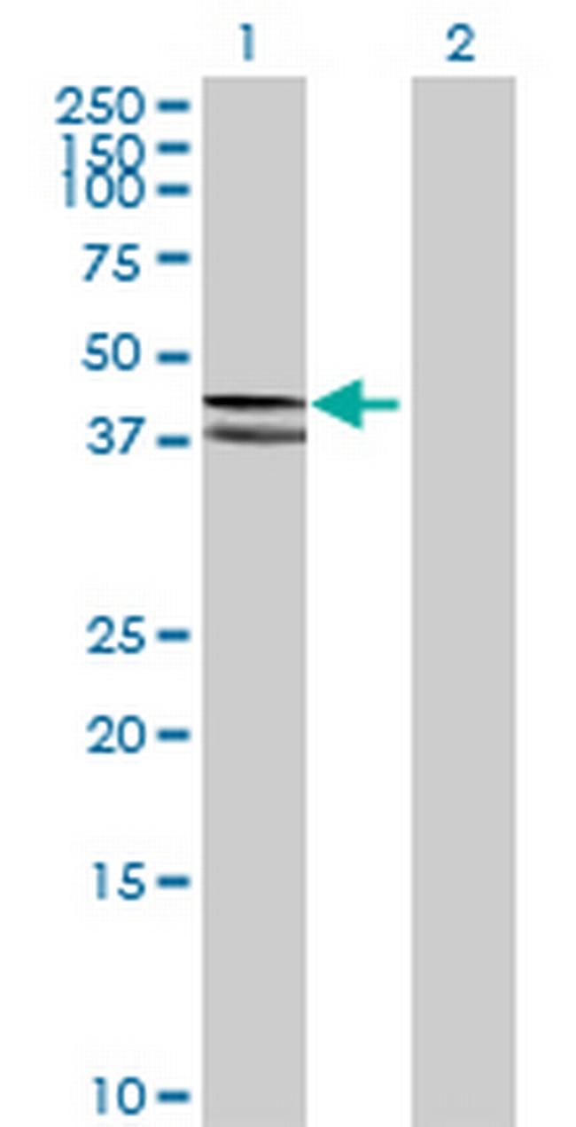 COX10 Antibody in Western Blot (WB)