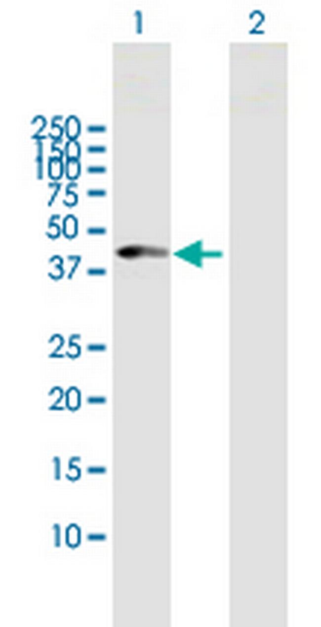 CPB1 Antibody in Western Blot (WB)