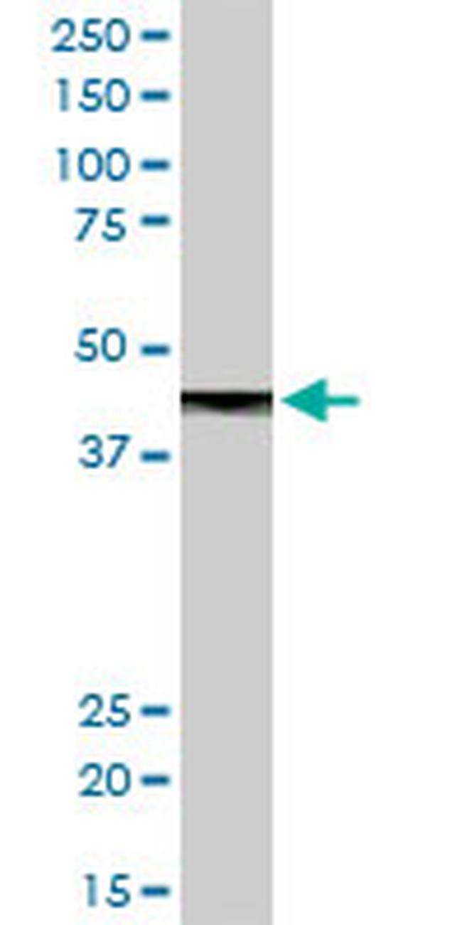 CPB1 Antibody in Western Blot (WB)