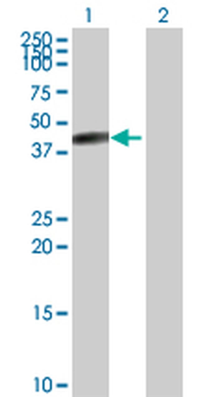 CPB1 Antibody in Western Blot (WB)