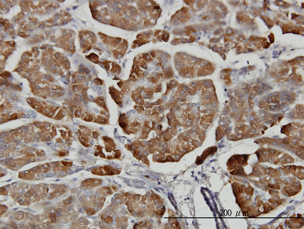 CPB1 Antibody in Immunohistochemistry (Paraffin) (IHC (P))