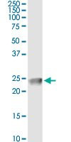 CLDN4 Antibody in Immunoprecipitation (IP)