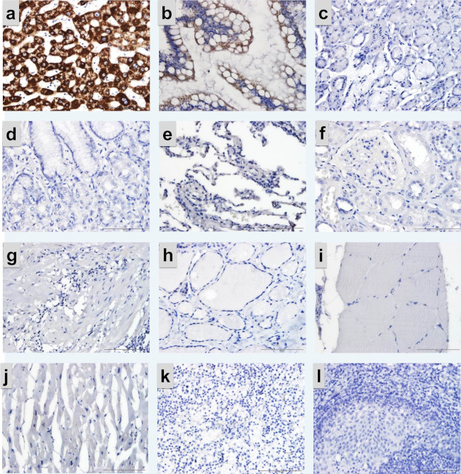 CPS1 Antibody in Immunohistochemistry (Paraffin) (IHC (P))