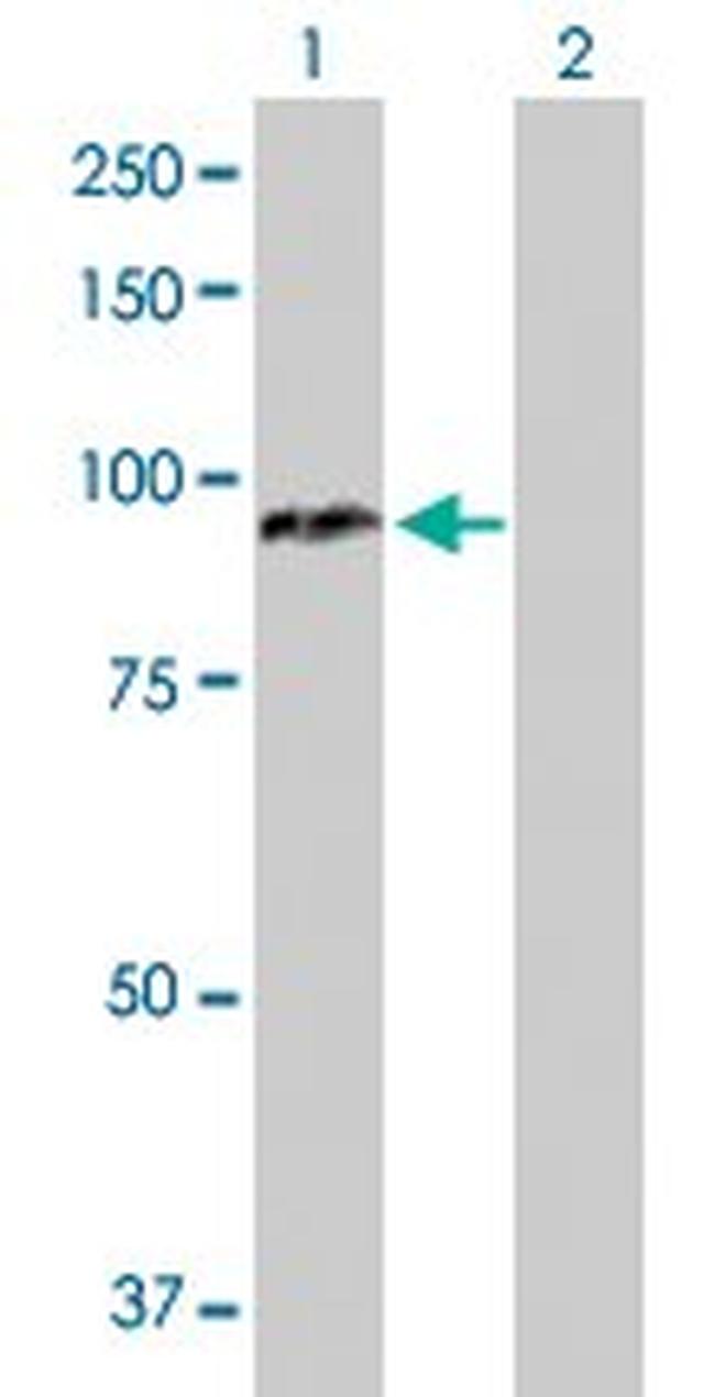 CPT1A Antibody in Western Blot (WB)