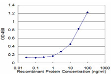 CPT1A Antibody in ELISA (ELISA)