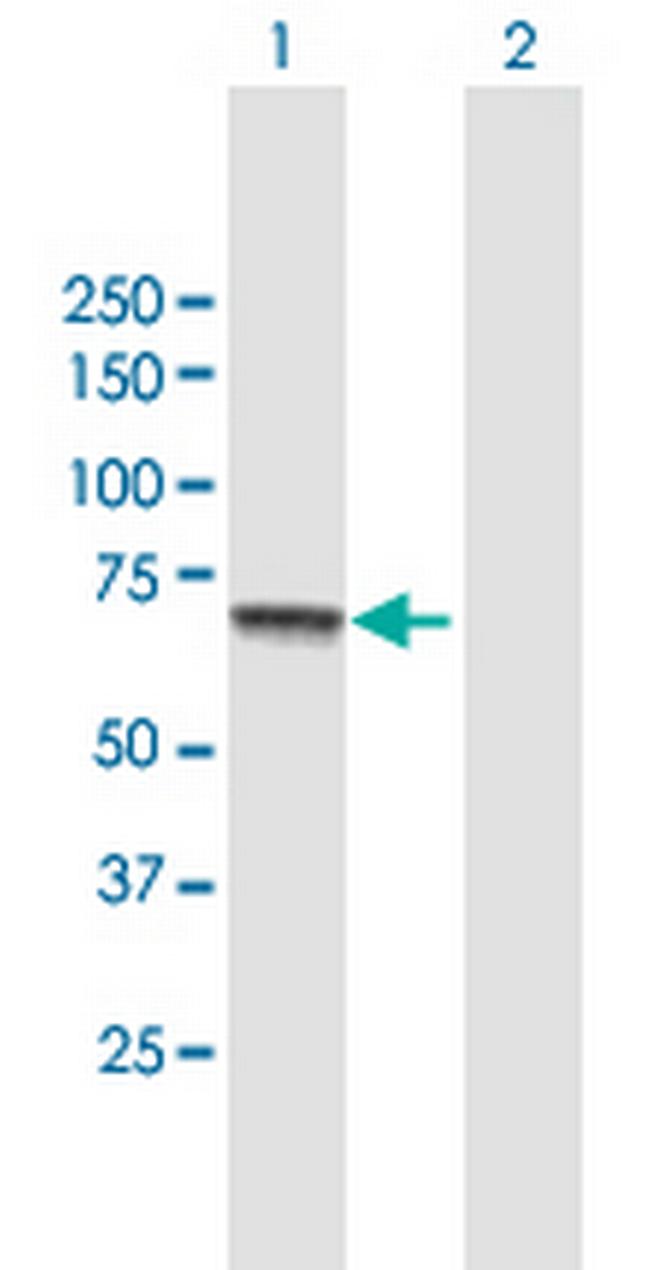 CPT2 Antibody in Western Blot (WB)