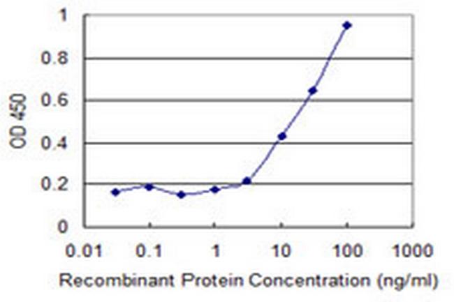 CPT2 Antibody in ELISA (ELISA)