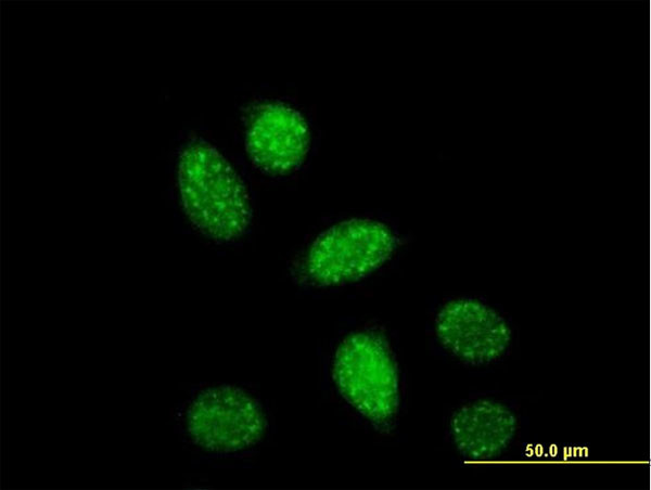 CREB1 Antibody in Immunocytochemistry (ICC/IF)