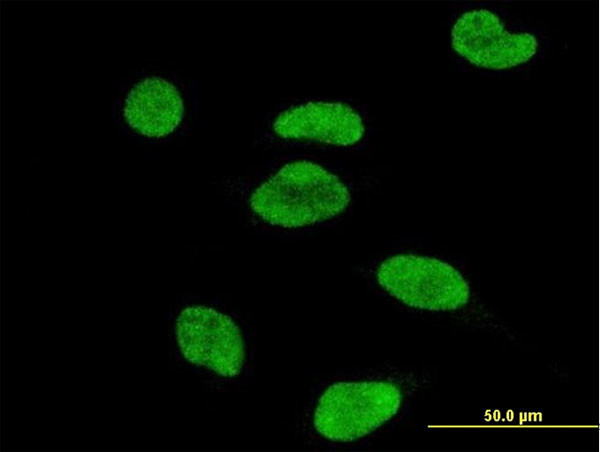 ATF2 Antibody in Immunocytochemistry (ICC/IF)