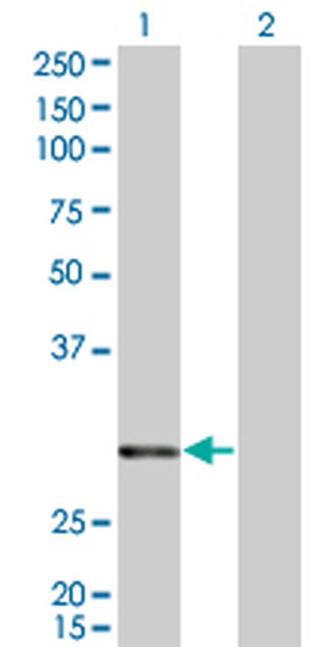 ATF2 Antibody in Western Blot (WB)