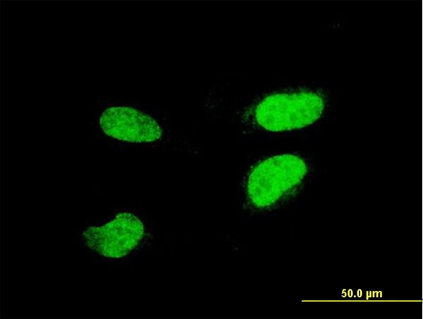 ATF2 Antibody in Immunocytochemistry (ICC/IF)