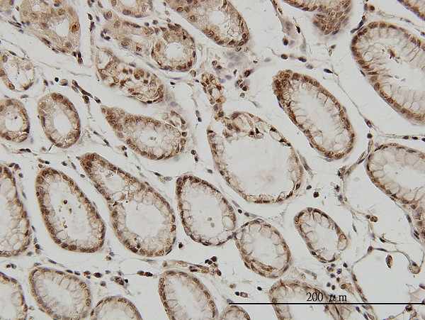 ATF2 Antibody in Immunohistochemistry (Paraffin) (IHC (P))