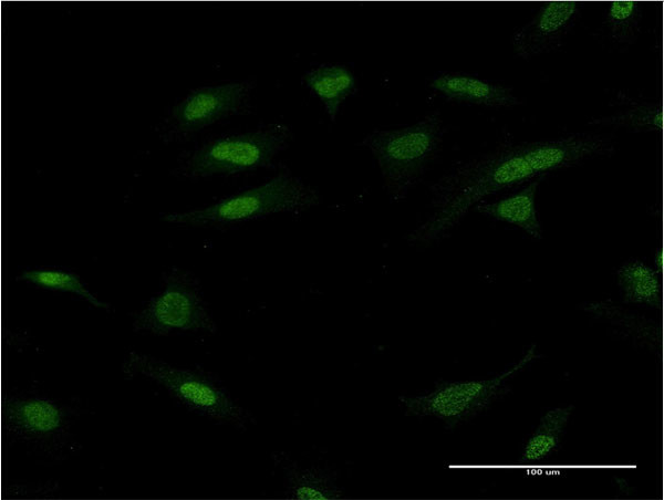 ATF2 Antibody in Immunocytochemistry (ICC/IF)