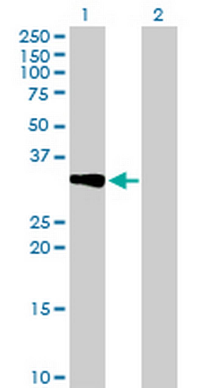 CRHBP Antibody in Western Blot (WB)